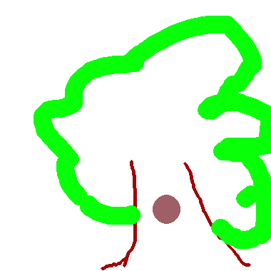 tree